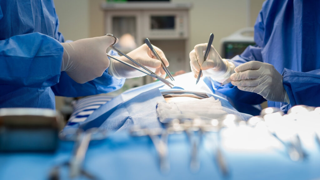 Ilustračná fotka - operácia