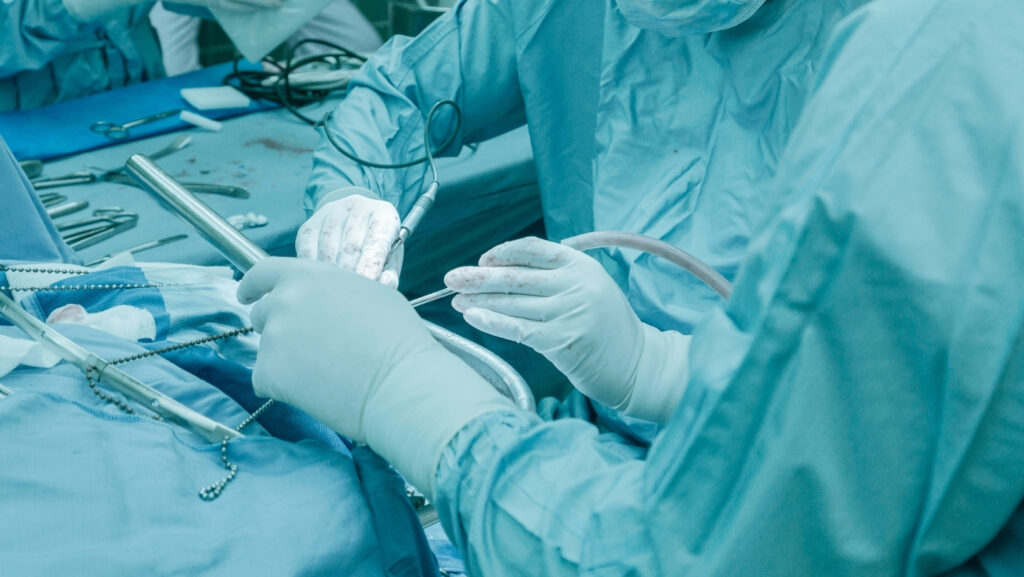 Ilustračná foto - neurochirurgia