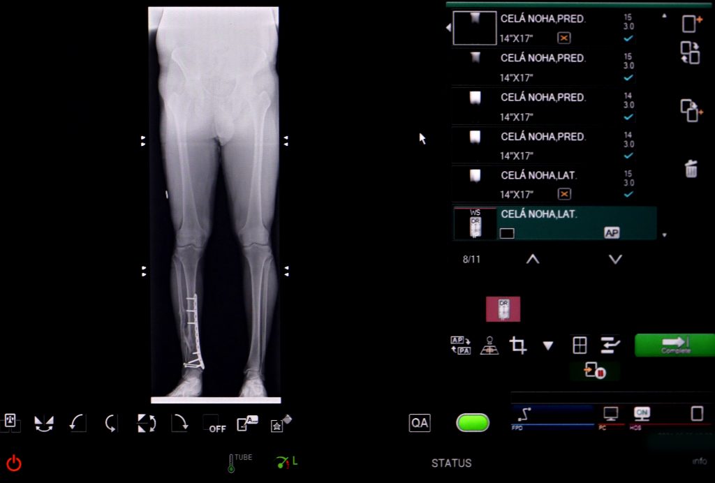 RTG flat panel snimka