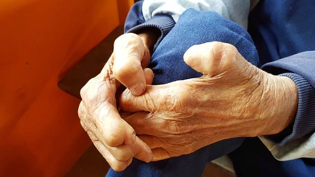 lepra _ ilustracne foto_dotyk.cz