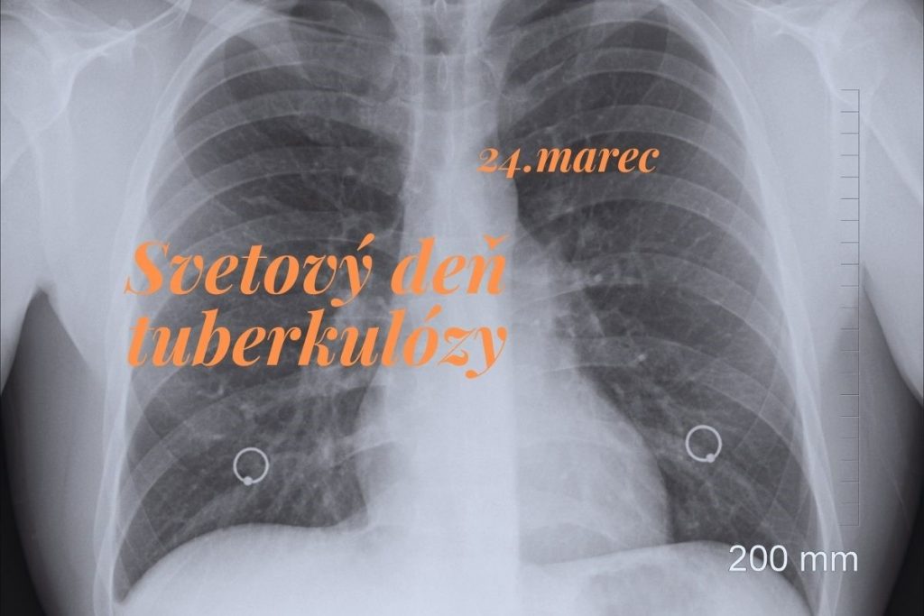Svetový deň tuberkulózy