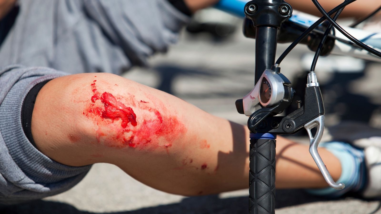 hemofilia_ uraz_ ilustracne foto