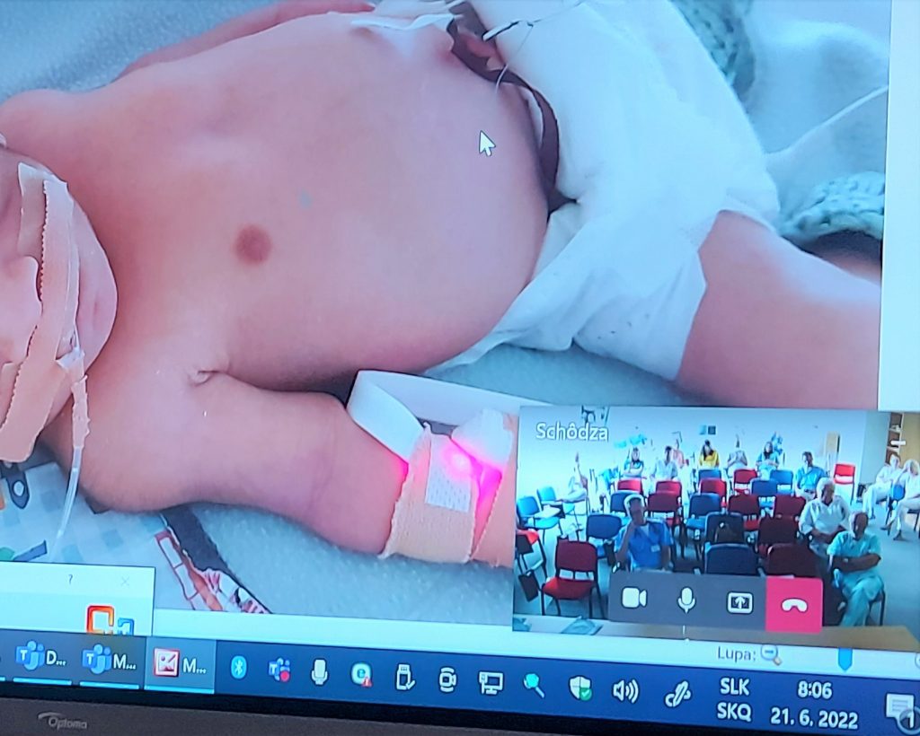 telekonferencia o novorodencovi