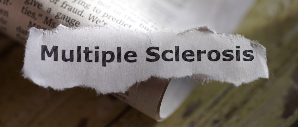 skleroza multiplex_ ilustračná fotografia