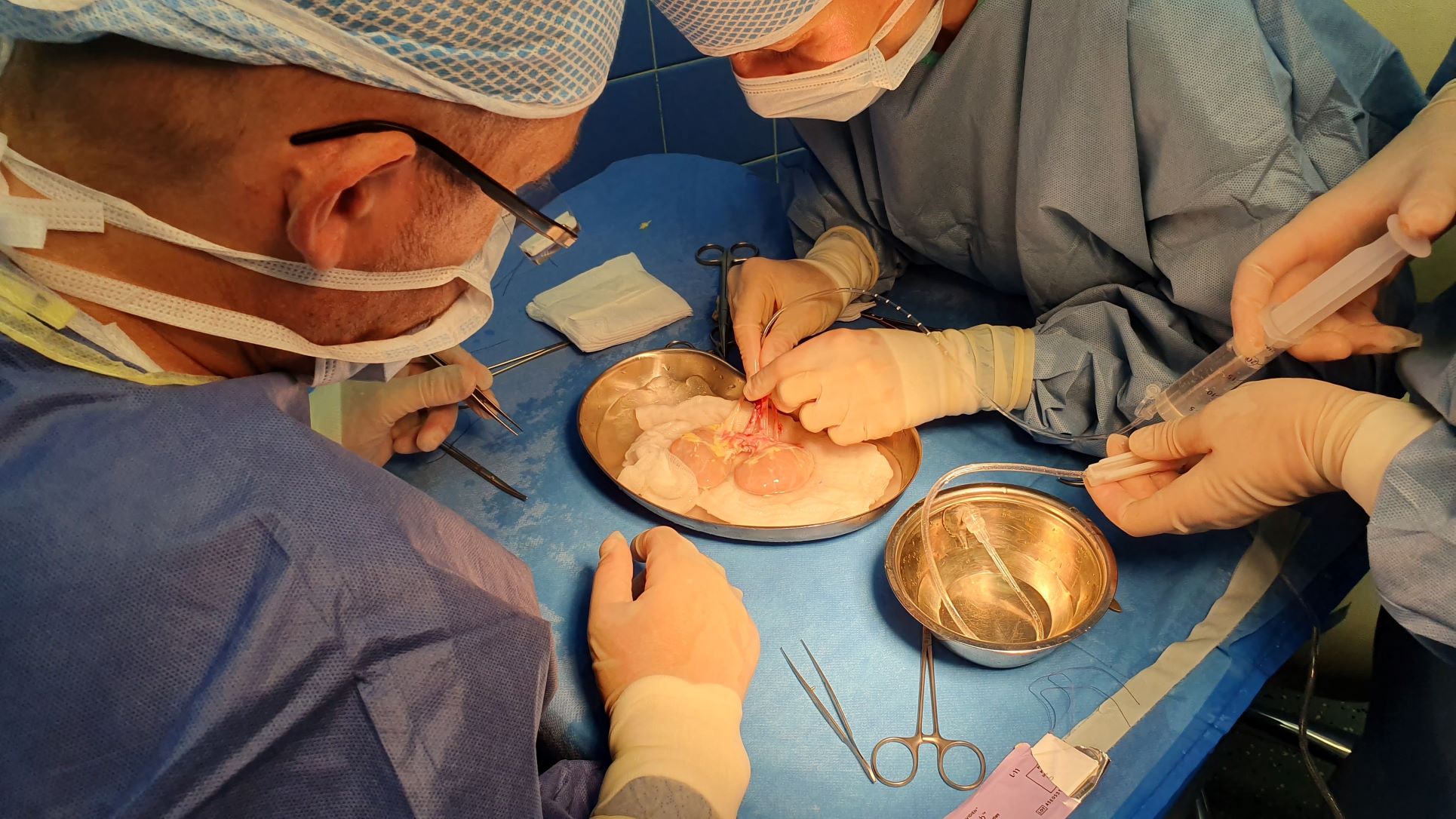 špecialisti v akcii_ transplantácia oblicky